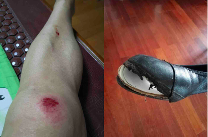 6月5日,在徐家汇地铁站口附近被警察故意推倒并暴力拖拽的维权老人受伤,随后被抓到徐家汇派出所。.png 6月5日,在徐家汇地铁站口附近被警察故意推倒并暴力拖拽的维权老人受伤,随后被抓到徐家汇派出所。.png