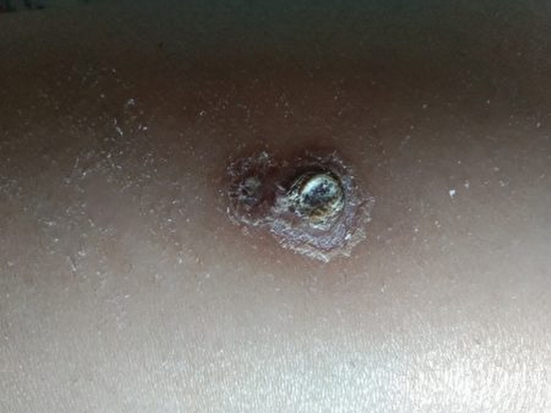 IMG_1689-e1599759975839.jpg IMG_1689-e1599759975839.jpg