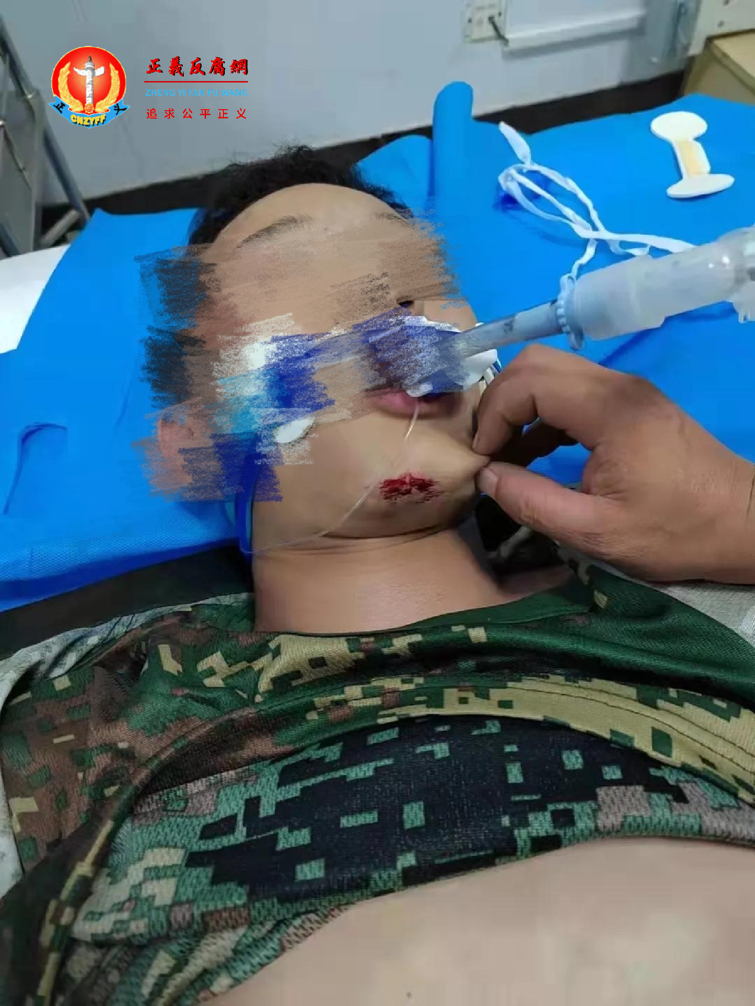 9月25日,山东交通技师学院商学院一名2021级新生周某某在校内突然死亡,家属发现他的嘴巴下颌角伤痕。.png 9月25日,山东交通技师学院商学院一名2021级新生周某某在校内突然死亡,家属发现他的嘴巴下颌角伤痕。.png