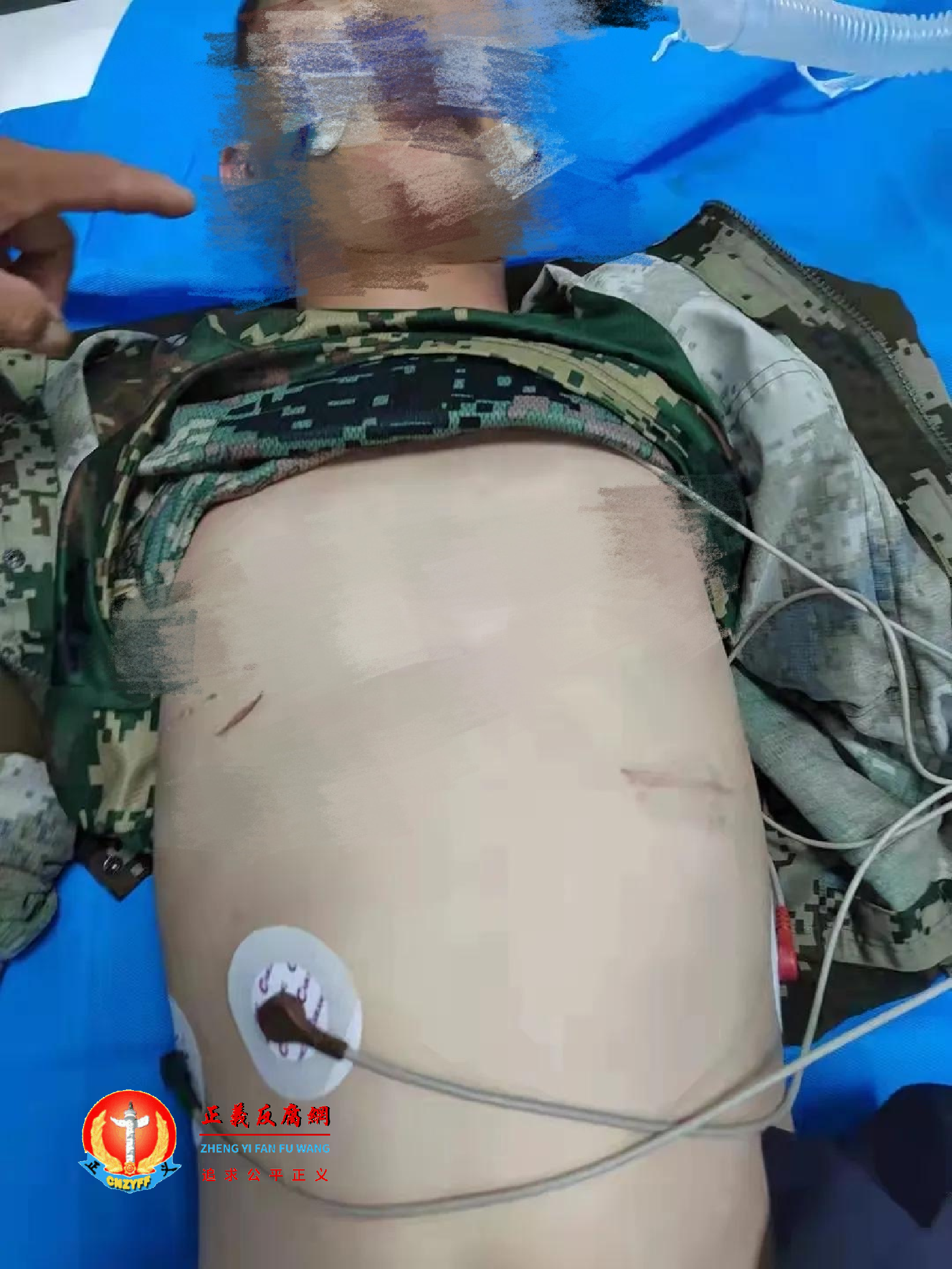 9月25日,山东交通技师学院商学院一名2021级新生周某某在校内突然死亡,家属发现他的身上有多处伤痕。.png 9月25日,山东交通技师学院商学院一名2021级新生周某某在校内突然死亡,家属发现他的身上有多处伤痕。.png