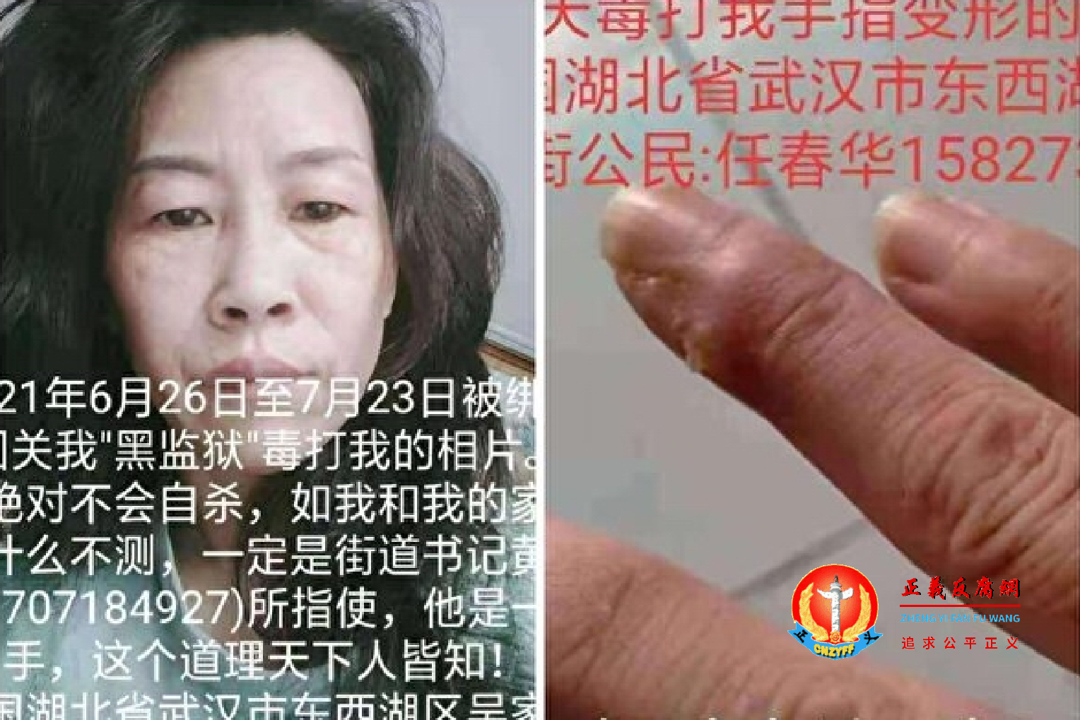 湖北省武汉市访民任春华,七一前遭地方政府绑架关黑监狱28天,遭黑保安脱光衣服电击全身、拍裸照,并强索疫情隔离费一万多元。.png 湖北省武汉市访民任春华,七一前遭地方政府绑架关黑监狱28天,遭黑保安脱光衣服电击全身、拍裸照,并强索疫情隔离费一万多元。.png