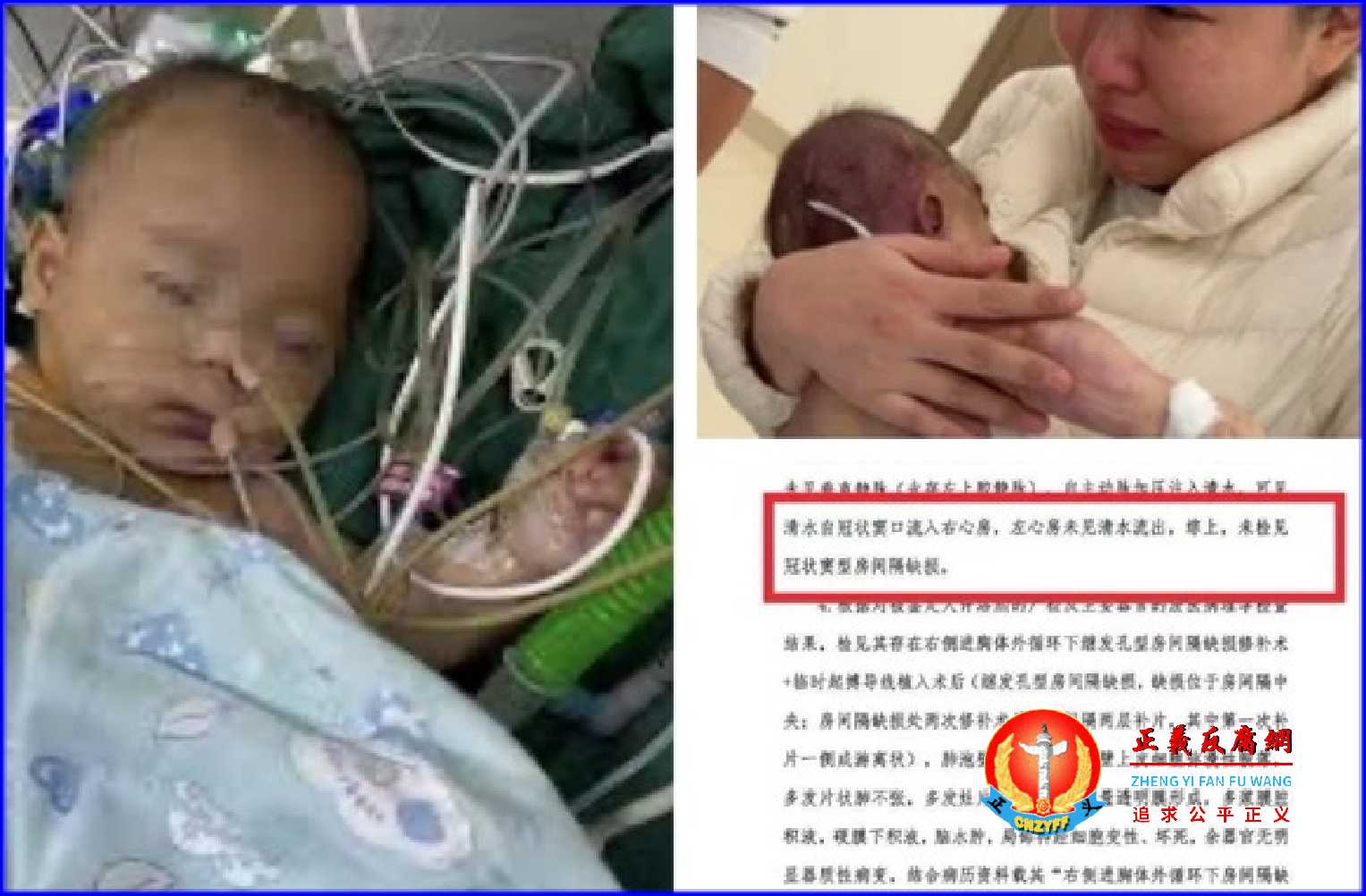 2025年12月19日，浙江宁波5月龄女婴小洛熙手术时离世的尸检报告出炉，显示手术存在重大问题。.jpg